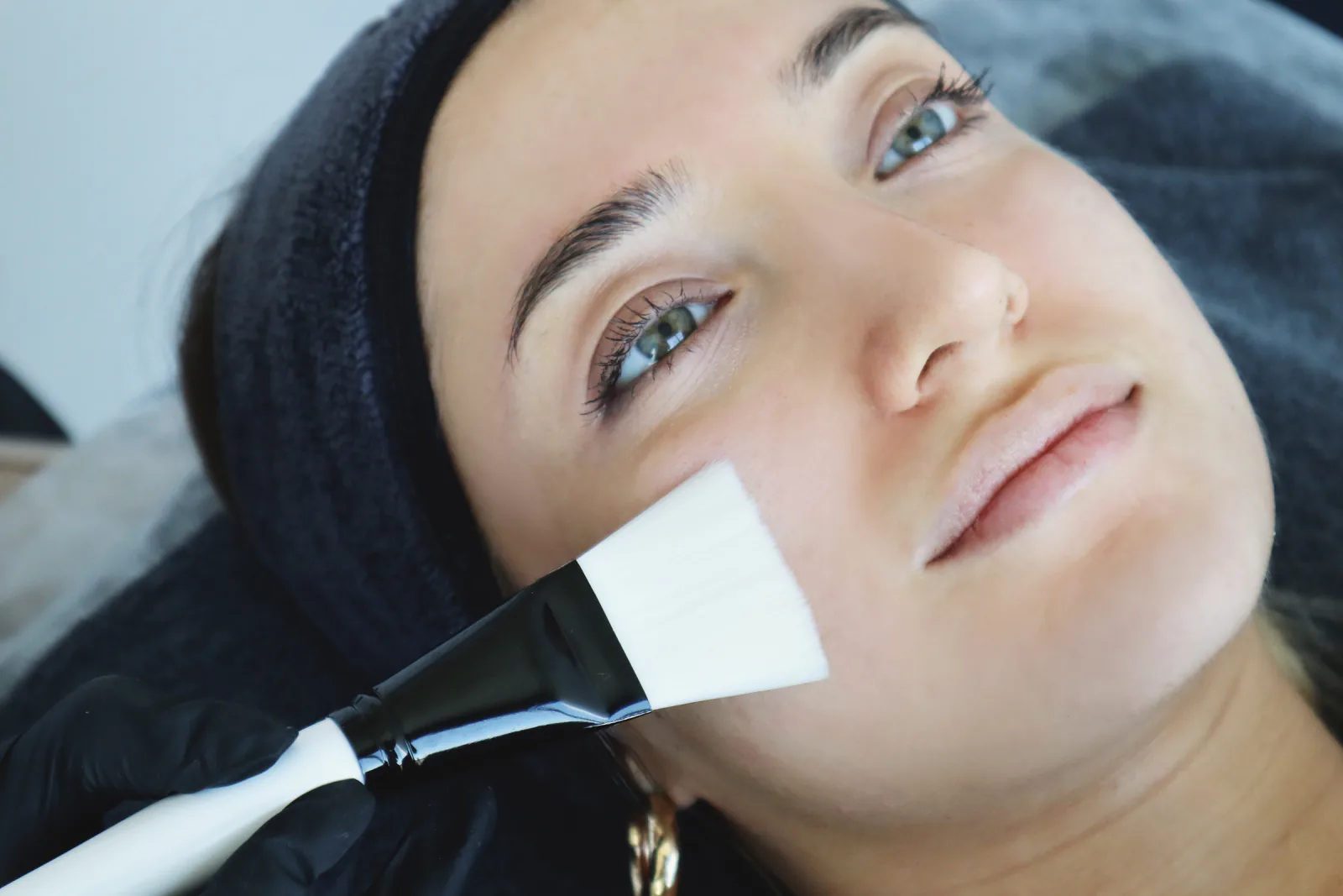 Akne bakımında yüze maske uygulaması